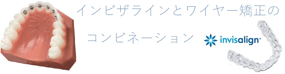 インビザラインとワイヤー矯正のコンビネーション