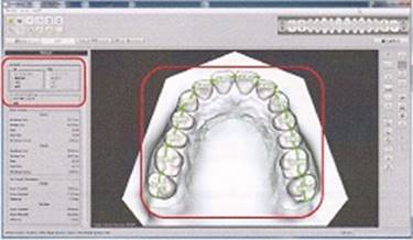 トランスクリアー、OrthoDesign