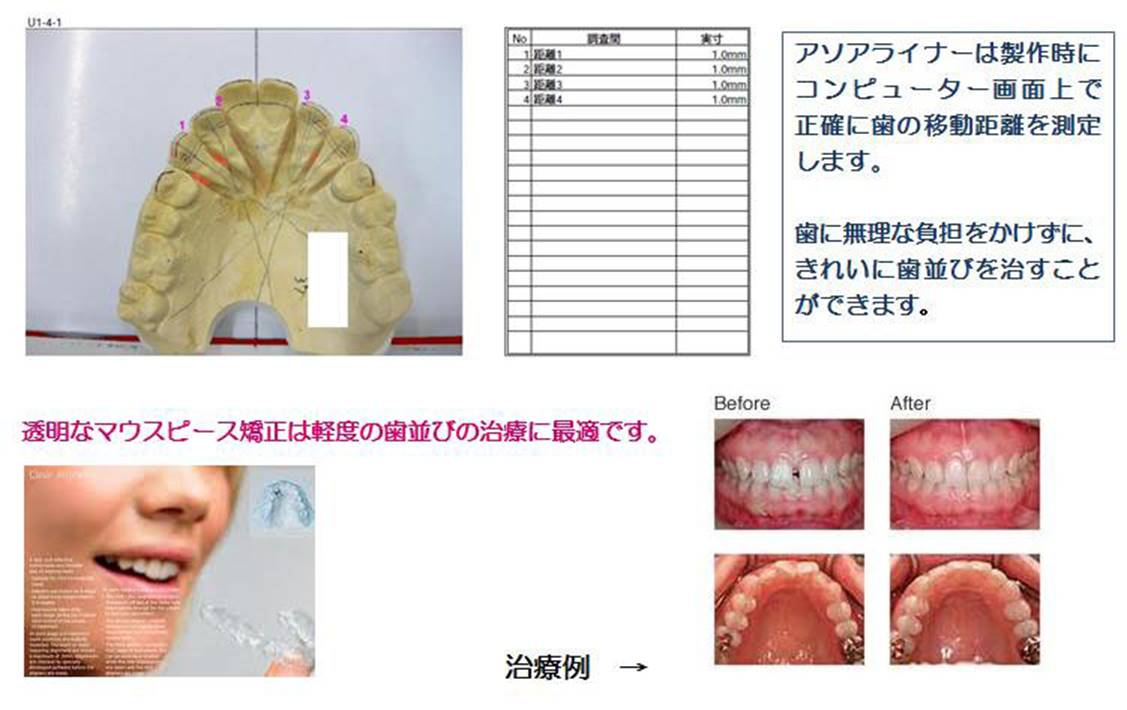 完全デジタル化