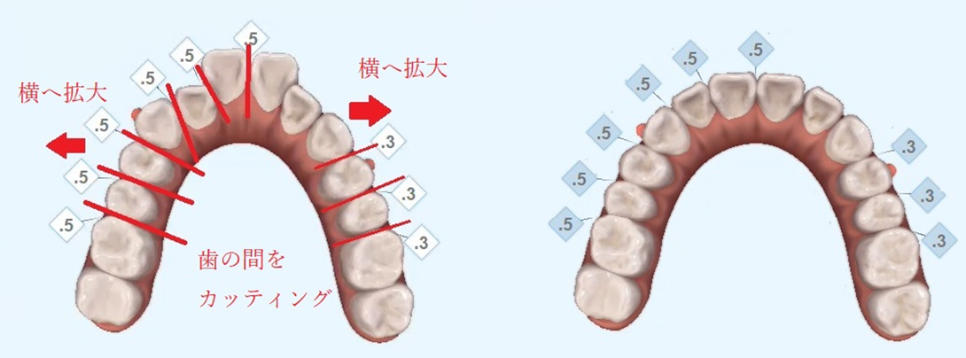 東京Biancoデンタルクリニックでよかった！納得のプランニング