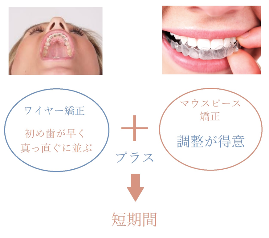 コラボ矯正の特徴